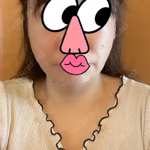 口コミ