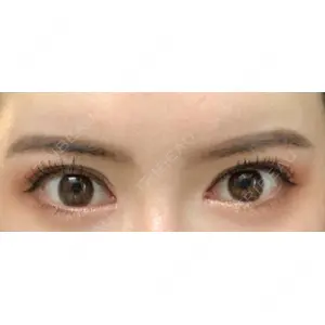 いちのせ形成外科・皮膚科 眼瞼＆フェイスクリニック口コミ