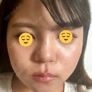 口コミ