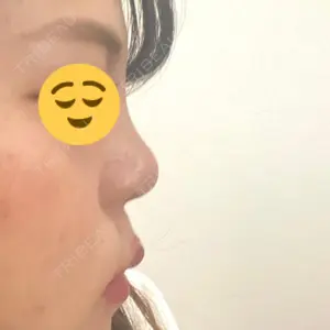 口コミ