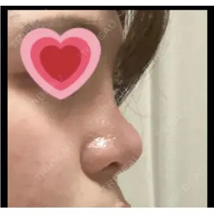 口コミ