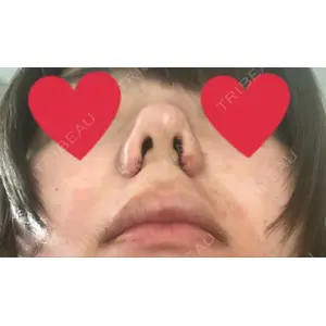 口コミ