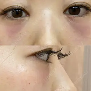 APOLLO BEAUTY CLINIC口コミ