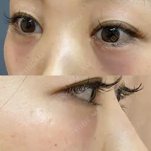 APOLLO BEAUTY CLINIC口コミ