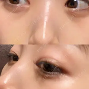 APOLLO BEAUTY CLINIC口コミ