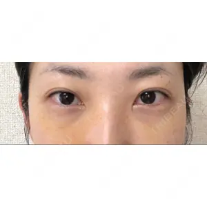 湘南美容クリニック 湘南美容クリニック 大阪京橋院口コミ
