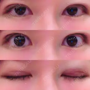 湘南美容クリニック 湘南美容クリニック 東京蒲田院口コミ