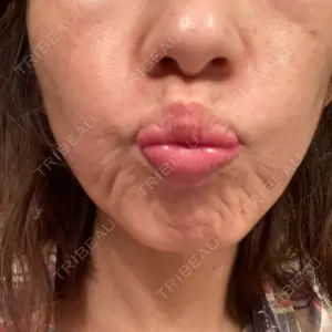 湘南美容クリニック 湘南美容クリニック 新宿本院口コミ