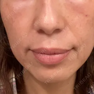 湘南美容クリニック 湘南美容クリニック 新宿本院口コミ