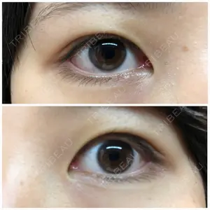 湘南美容クリニック 湘南美容クリニック 新宿本院口コミ