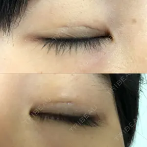 湘南美容クリニック 湘南美容クリニック 新宿本院口コミ