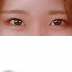 TCB東京中央美容外科 TCB東京中央美容外科 梅田茶屋町院口コミ