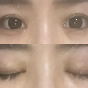グローバルビューティークリニック グローバルビューティークリニック 東京院口コミ