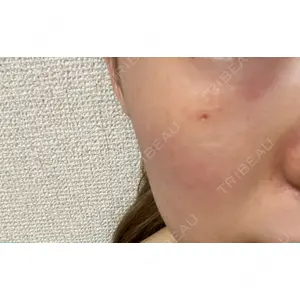 東京皮膚科・形成外科 東京皮膚科・形成外科 (銀座いけだクリニック)口コミ