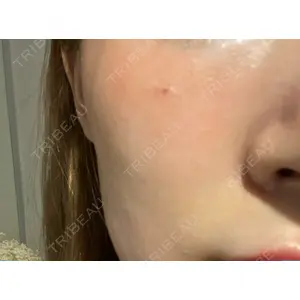 東京皮膚科・形成外科 東京皮膚科・形成外科 (銀座いけだクリニック)口コミ