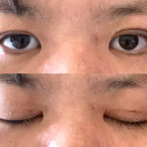 A CLINIC（エークリニック） A CLINIC（エークリニック） 銀座院口コミ