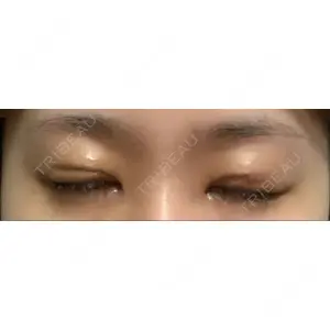 いちのせ形成外科・皮膚科 眼瞼＆フェイスクリニック口コミ