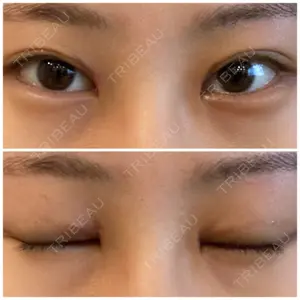 聖心美容クリニック グループ 聖心美容クリニック 六本木院口コミ