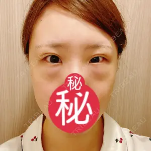 TCB東京中央美容外科 TCB東京中央美容外科 梅田茶屋町院口コミ