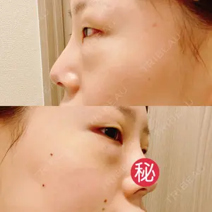 TCB東京中央美容外科 TCB東京中央美容外科 梅田茶屋町院口コミ