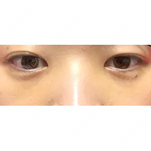 APOLLO BEAUTY CLINIC口コミ