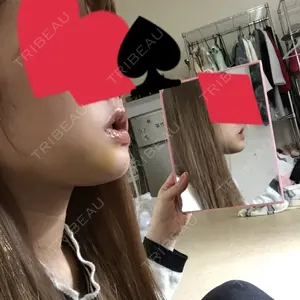 口コミ