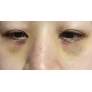 APOLLO BEAUTY CLINIC口コミ