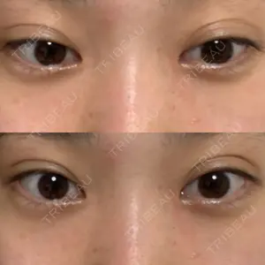 R Beauty CLINIC R Beauty CLINIC 銀座院口コミ