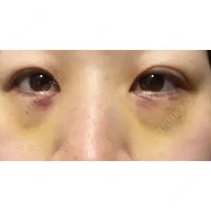 APOLLO BEAUTY CLINIC口コミ