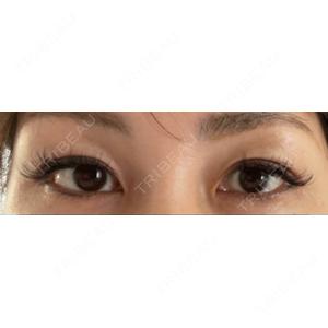 有楽町美容外科クリニック口コミ