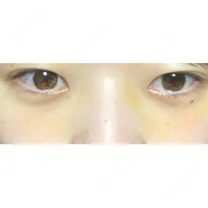 APOLLO BEAUTY CLINIC口コミ