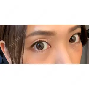 JBCジュノビューティークリニック 新宿三丁目院口コミ