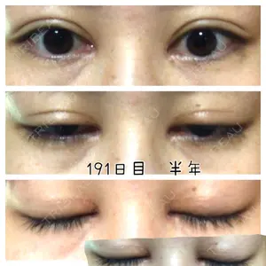 いちのせ形成外科・皮膚科 眼瞼＆フェイスクリニック口コミ