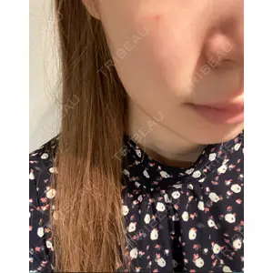 東京皮膚科・形成外科 東京皮膚科・形成外科 (銀座いけだクリニック)口コミ