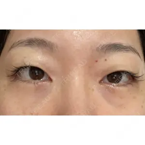 APOLLO BEAUTY CLINIC口コミ