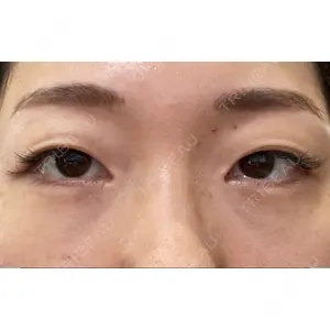 APOLLO BEAUTY CLINIC口コミ