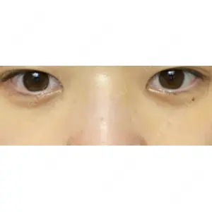 APOLLO BEAUTY CLINIC口コミ