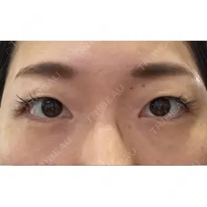 APOLLO BEAUTY CLINIC口コミ