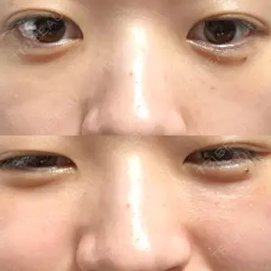 APOLLO BEAUTY CLINIC口コミ