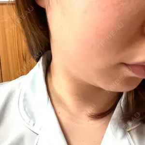 南青山TOKUNAKAクリニック口コミ