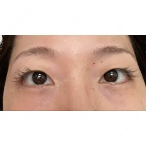 APOLLO BEAUTY CLINIC口コミ