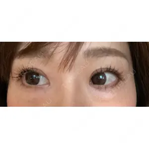 口コミ