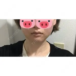 口コミ