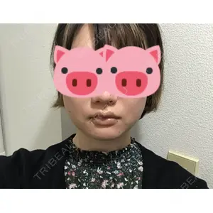 口コミ
