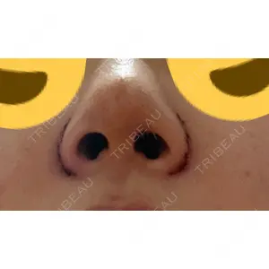 口コミ
