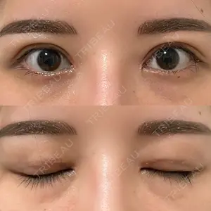 いちのせ形成外科・皮膚科 眼瞼＆フェイスクリニック口コミ