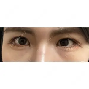 APOLLO BEAUTY CLINIC口コミ