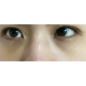 APOLLO BEAUTY CLINIC口コミ