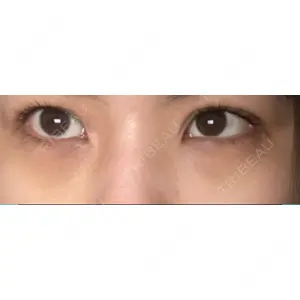 APOLLO BEAUTY CLINIC口コミ