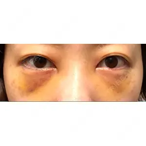 APOLLO BEAUTY CLINIC口コミ
